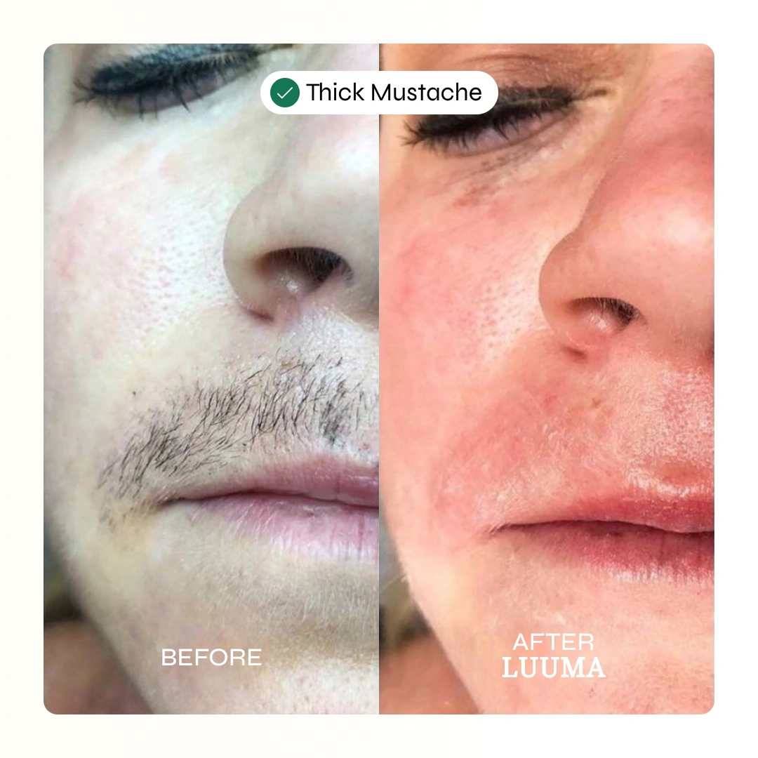 Velva Face Waxing Kit