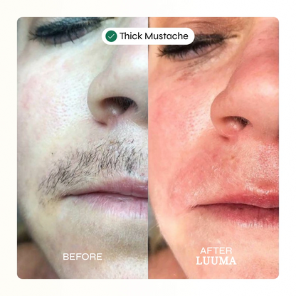 Velva Face Waxing Kit