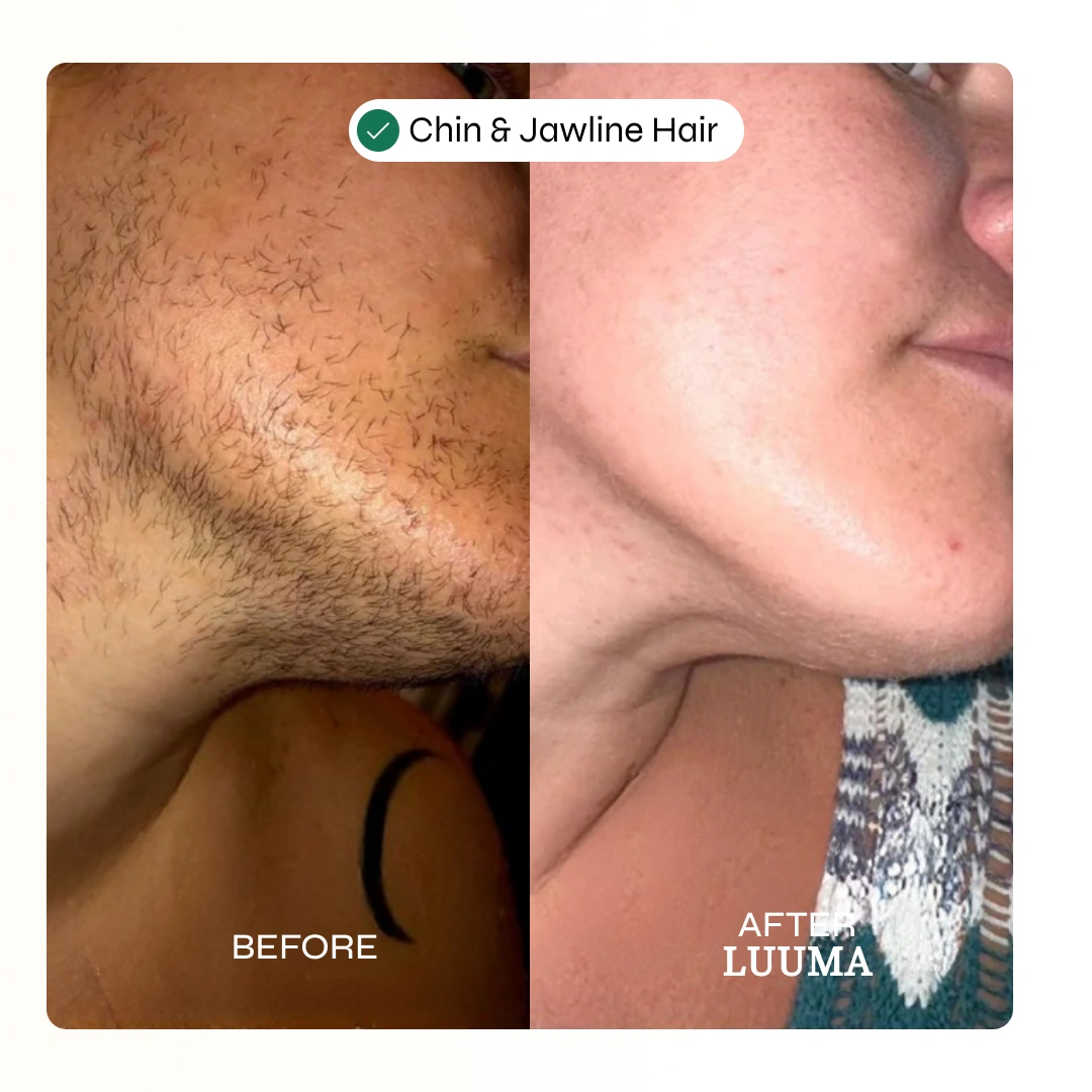 Velva Face Waxing Kit