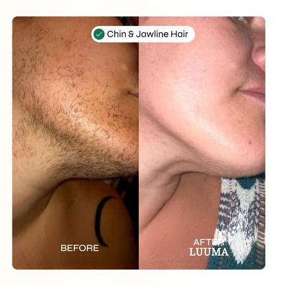 Velva Face Waxing Kit